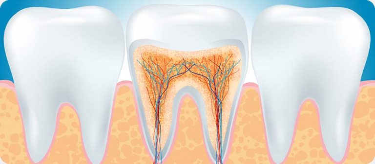 Calgary Root Canal Therapy - Endodontics | West Peaks Dental Suite